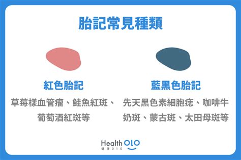 胎記傳說|胎記怎麼產生、何時消除？醫師剖析胎記種類、胎記寓意